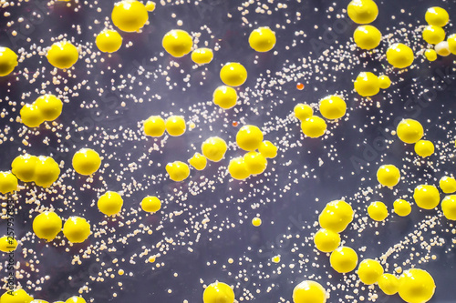 Bacteria grown from skin smear, colonies of Micrococcus luteus and Staphylococcus epidermidis on Petri dish with Tryptic soy agar, close-up view photo