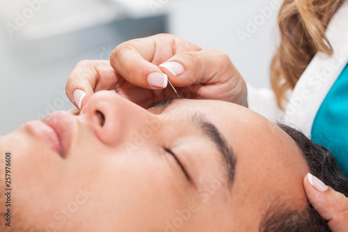 Doctor performing facial acupuncture on a young male patient
