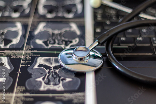 Medical stethoscope and CT scan. on laptop computer Medical concept photo