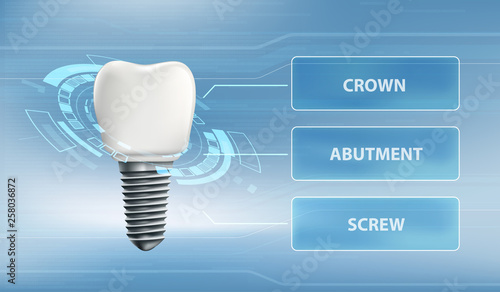 Dental implant with screw and crown. Technology user interface.