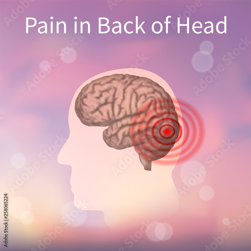 Pain in back of the head. Vector realistic anatomy illustration. Pink abstract background.