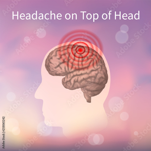 Headache on top of the head. Vector realistic anatomy illustration. Pink abstract background.