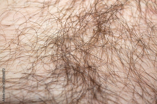 hair texture on male skin 