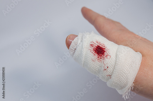 a finger in bloody bandage photo