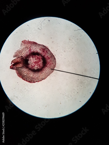 cross section : Dicot root photo