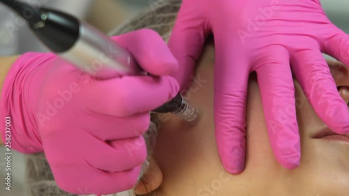 Close-up of a beauty salon specialist performing the micro-needling mesotherapy treatment with a derma-pen machine.