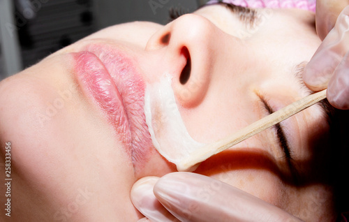 Depilation with hot wax mustache in the beauty salon. Young woman receiving facial epilation close up. Cosmetologist removes hair on face. Beauty salon, mustache depilation.