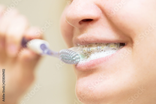 girl with braces brushing her teeth