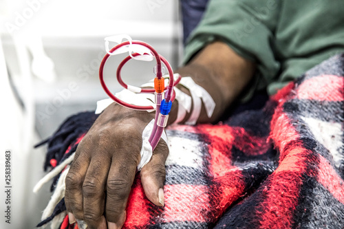 Konstfotografi hemodialysis in people on the equipment