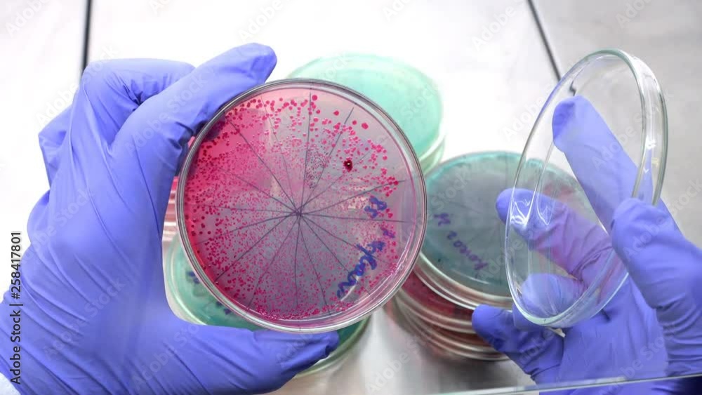Bacteria red on agar. A scientist opens a Petri dish and examines red