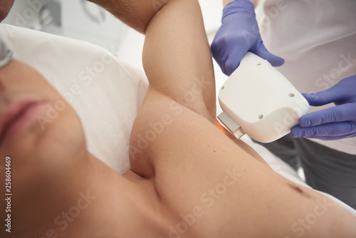 Laser hair removal procedure of armpit to man