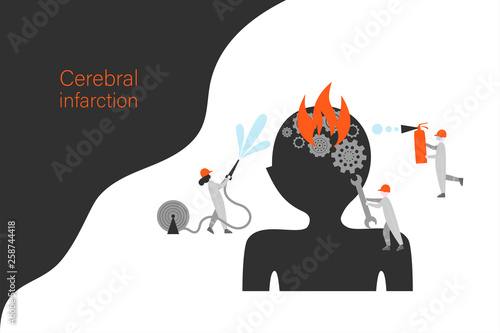 Cerebral infarction vector banner template