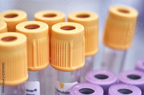 macro of test tubes with yellow top, against a gradient of white background. Concept of good health