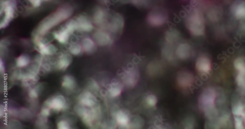 Microskopie eines Bakteriums