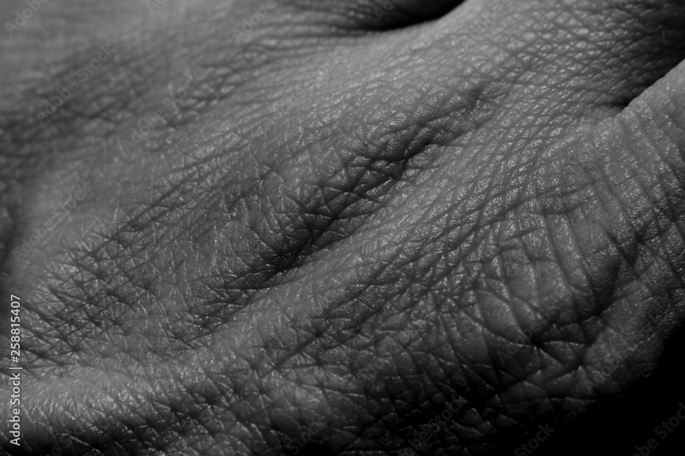 Wrinkles Wrinkles