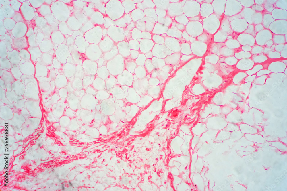 Human fat body tissue under microscope view. Stock Photo Adobe Stock