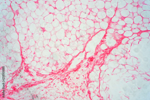 фотографія Human fat body tissue under microscope view.