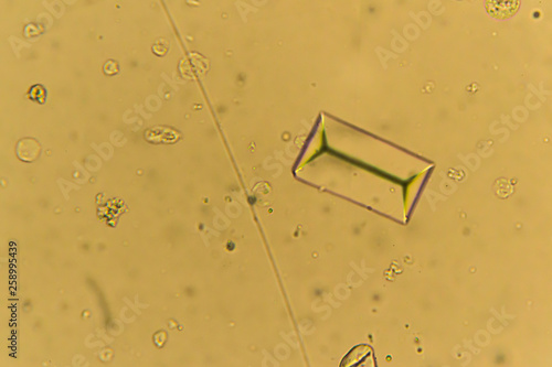 Struvites at the microscope. Urine sample from a dog who urinate frequently