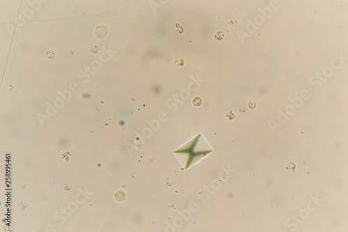 Papier peint Calcium oxalate at the microscope