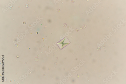 Photos Calcium oxalate at the microscope