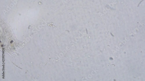 Microscopic organism swimming around in circles photo