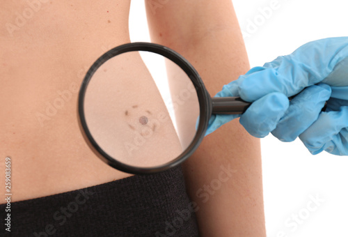 Dermatologist examining moles of patient on light background, closeup