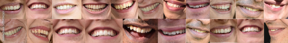 Obraz premium lachen, Mund und Lippen, Zähne