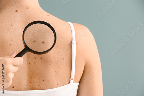 Dermatologist examining moles of patient on grey background photo