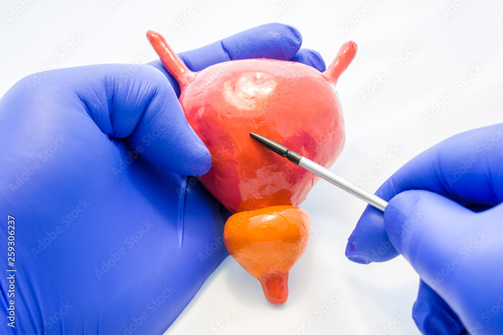 Doctor or scientist showing with pointer to body of human bladder on 3D anatomical model. Introduction to anatomical features of bladder, place of origin of pathologies and diseases Doctor or scientist showing with pointer to body of human bladder on 3D anatomical model. Introduction to anatomical features of bladder, place of origin of pathologies and diseases