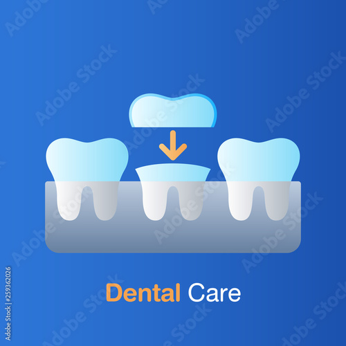 Dental care concept. Implant dentistry, prevention, check up and dental treatment.