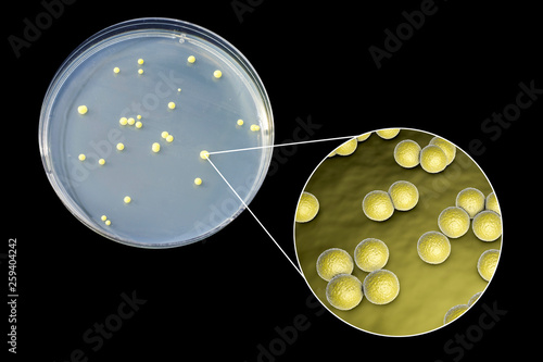 Colonies of Micrococcus luteus bacteria on agar plate and close up view of micrococci bacteria, photo and 3D illustration photo