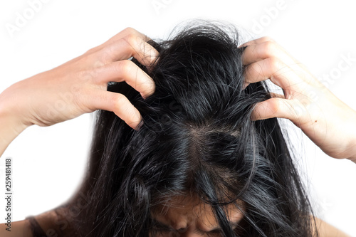 women head with dandruff Caused by the problem of dirty. Or caused by skin disease or Seborrheic Dermatitis. It has white scaly and it will cause itch.