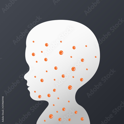 Rubella German Measles logo icon design, vector illustration