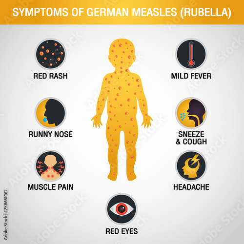 Rubella German Measles logo icon design, vector illustration photo