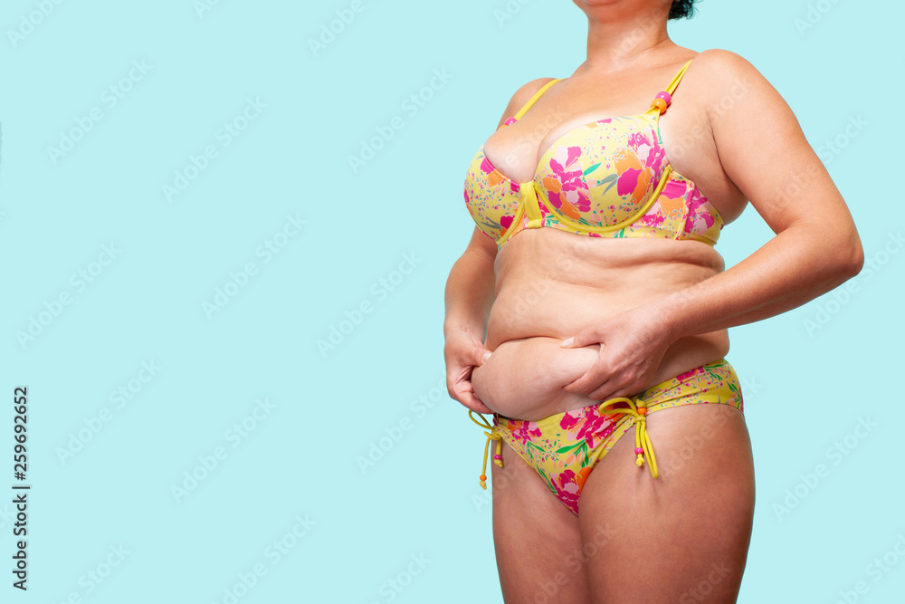 Woman holding Skin of the skin, Cellulite on female Body. Blue Background.  Studio shot. Flabby Body, saggy tummy. Fat Woman Body - Image Stock Photo |  Adobe Stock