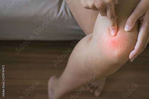 Wallpaper Mural Woman having a knee pain,Female feeling stale and exhausted with painful on legs Torontodigital.ca