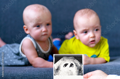 Photo ultrasound twins. In the background are twins, a boy and a girl of 7 months. Maternity.