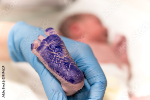 Photos newborn baby footprint in hospital and blue ink over