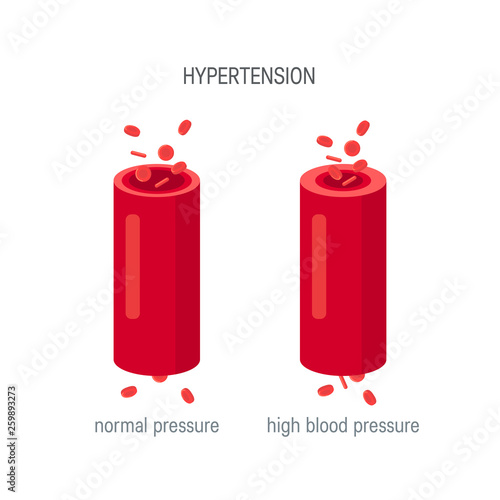 Blood pressure concept in flat style, vector