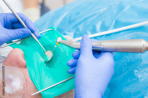 Fotografia Closeup picture of dental instruments: drill and needle for root canal treatment