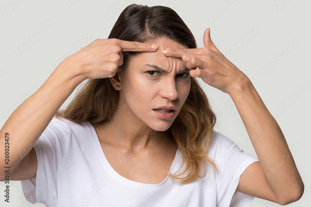 Fototapeta premium Dissatisfied woman squeeze pimples looking at camera feels angry