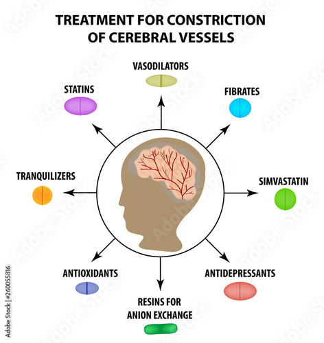 Treatment of cerebral vascular constriction. World Stroke Day. Infographics. Vector illustration on isolated background
