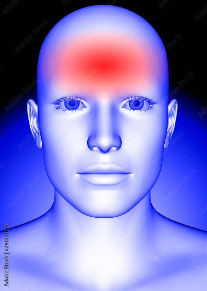 Headache - 3D Headache - 3D