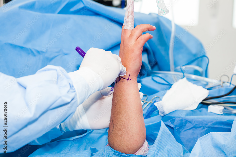 Fototapeta premium Orthopedic surgeon marking the surgical site just before performing a wrist arthroscopy on a male patient