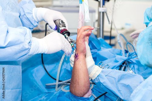 Group of orthopedic surgeons performing a wrist arthroscopy on a male patient photo