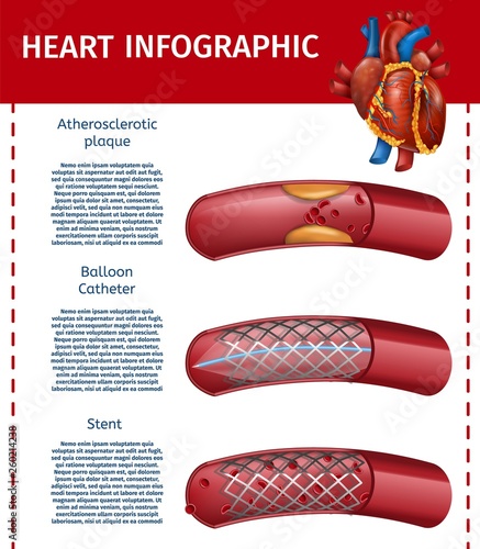 Realistic Heart Infographic Surgery Therapy Banner