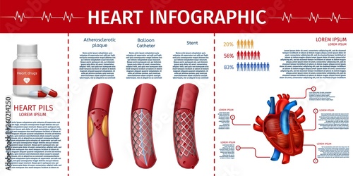 Heart and Cardiovascular Therapy Infographic Page