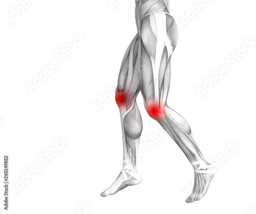 Conceptual knee human anatomy with red hot spot inflammation or articular joint pain for leg health care therapy or sport muscle concepts. 3D illustration man arthritis or bone osteoporosis disease © high_resolution
