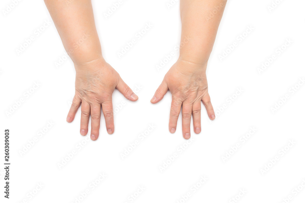 The hands of an elderly woman with wrinkles and dry skin, dehydration, white background, isolate, dermatology