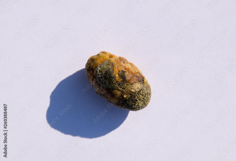 Naklejka premium Stone of gallbladder. The result of gallstones. A calculus of heterogeneous composition.